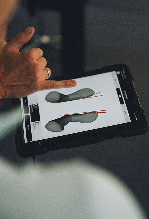 Fußscan beim Fly Out