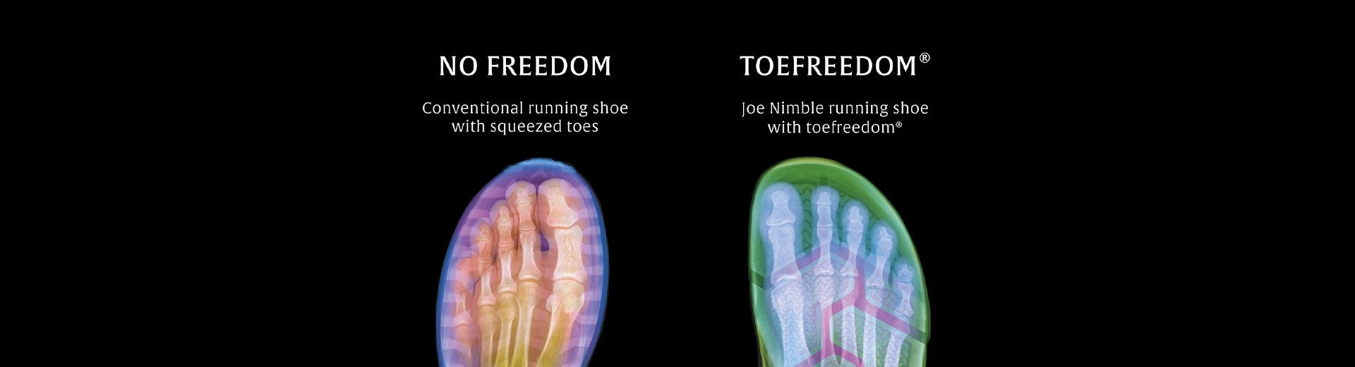 Füße im Schuh mit Zehenfreiheit und ohne Zehenfreiheit im Röntgenbild/Xray dargestellt